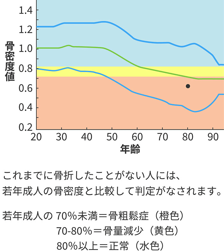 年齢と骨密度値のグラフ | これまでに骨折したことがない人には、若年成人の骨密度と比較して判定がなされます。| 若年成人の70%未満=骨粗鬆症、70-80%=骨量減少、80%以上=正常