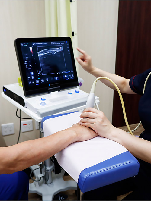 関節エコー検査